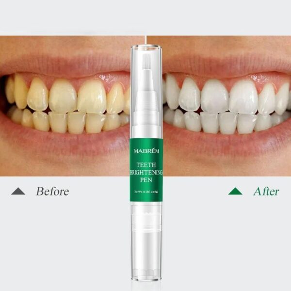 Instant Teeth Whitening Pen - Image 5